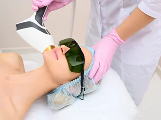 Frakčný laserový resurfacing